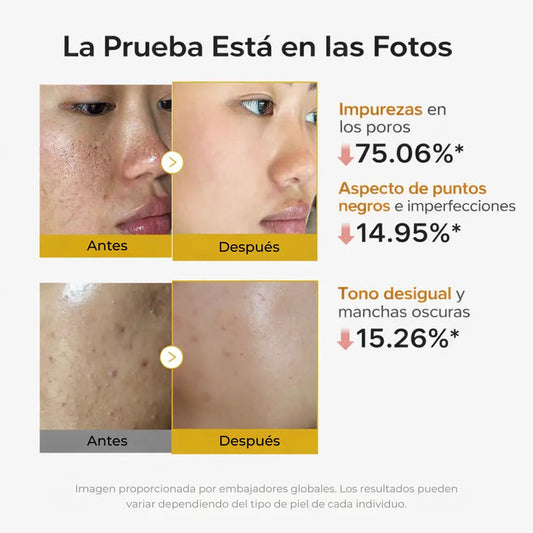 Medicube - Kojic Acid Tumeric Peel Shoot