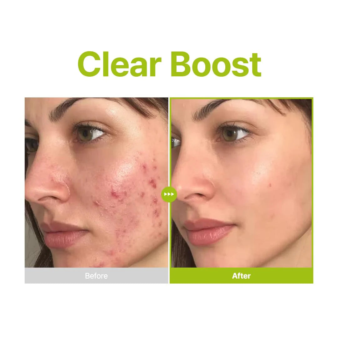 Purito - Azelaic Acid 10 Kojic Tea Tree Serum