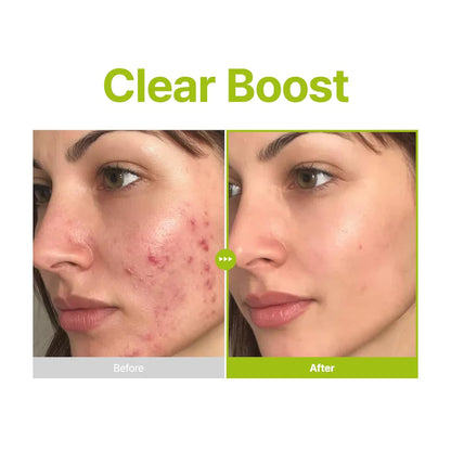 Purito - Azelaic Acid 10 Kojic Tea Tree Serum