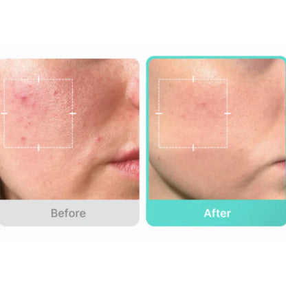 Medicube - Azelaic Acid 16 BB Calming Serum
