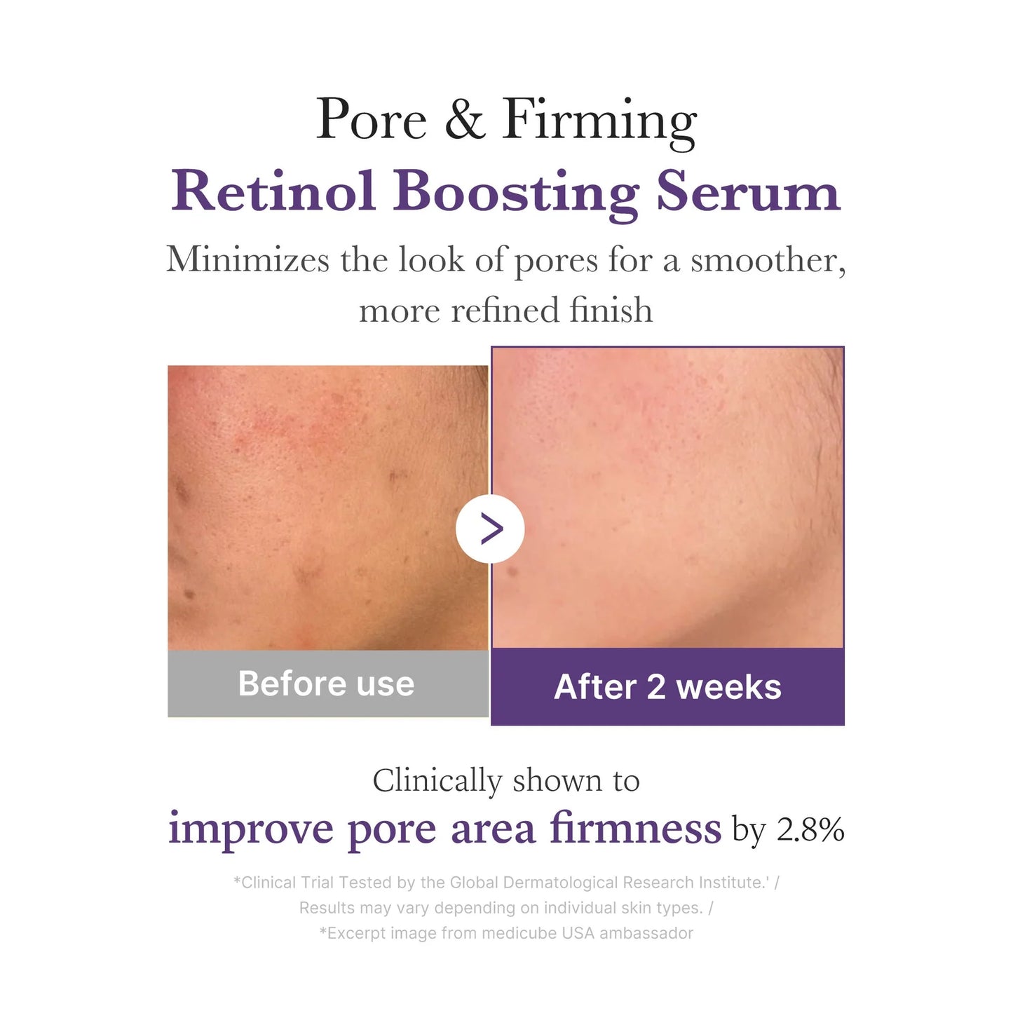 Medicube - Retinol NMN Boosting Serum